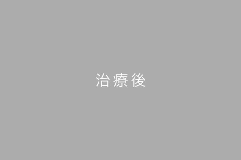 治療後